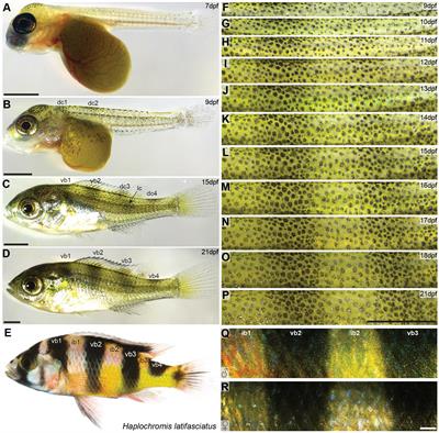 Developmental and Cellular Basis of Vertical Bar Color Patterns in the East African Cichlid Fish Haplochromis latifasciatus